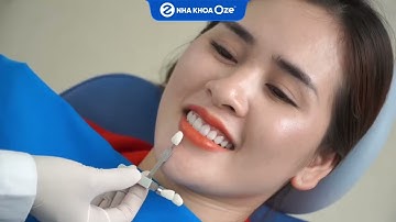 ✨ HÀNH TRÌNH LỘT XÁC HÀM RĂNG XỈN MÀU NHỜ BỌC RĂNG SỨ