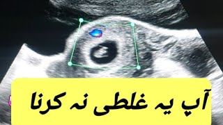 First response pregnancy test |Signs of Pregnancy | Positive Pregnancy Test | Pregnancy Symptoms usg