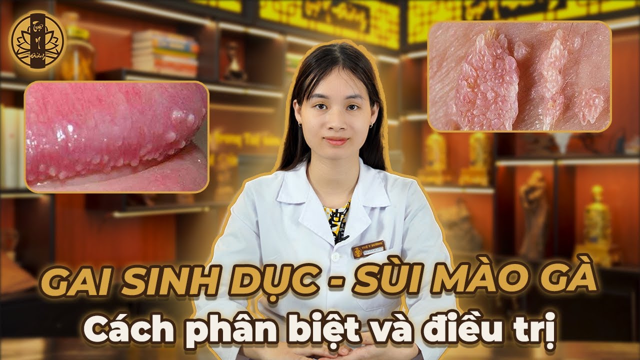 PHÂN BIỆT GAI SINH DỤC VÀ SÙI MÀO GÀ - DẤU HIỆU ĐẶC TRƯNG NHẬN DIỆN SÙI