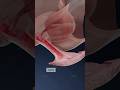 What Is ATROPHIC VAGINITIS And How Does It Affect Vaginal Health 3D Visualization What Is ATROPHIC VAGINITIS And How Does It Affect Vaginal Health 3D Visualization