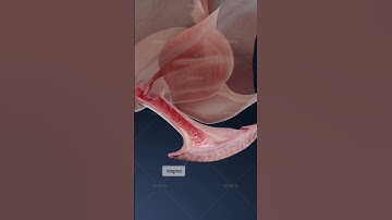 What is ATROPHIC VAGINITIS and how does it affect vaginal health? 3D visualization