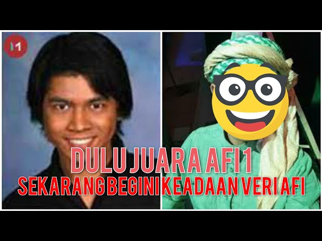 Sempat menjadi Artis terkenal..SEKARANG BEGINI keadaannya class=