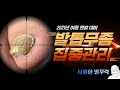 (Eng)무좀발톱 치료/케어 필요하신 우리 아버님(ft. 스케일링) l Fungal/Ingrown toenails [NP케어]