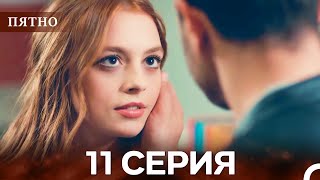 Пятно Cерия 11 Русский Дубляж