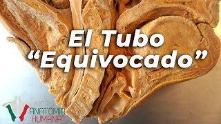 ¿Qué pasaría si algo entrara por el tubo equivocado? ¿Qué tan malo sería si pasara?