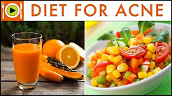 Best Foods for Acne Treatment | Healthy Recipes