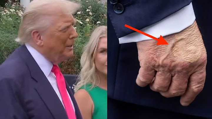 UPDATE: Cause of Trump’s VIRAL hand photo REVEALED