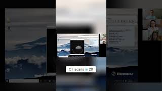 ImageJ File Size Too Big  Reduce It in SECONDS!