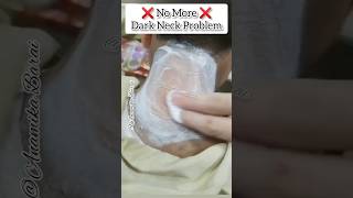 Dark Neck Home Remedy?/Best Dark Neck Removal shorts skincare darkneck youtubeshorts viral