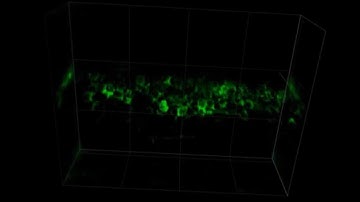 Fast Calcium Imaging with Optical Sectioning via HiLo Microscopy