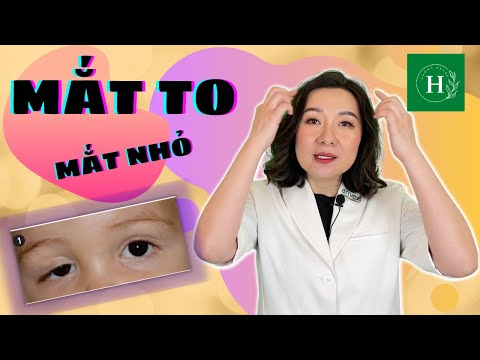 Hai Mắt Không Cân Đối - Mắt to Mắt nhỏ không khó xử lý như mọi người vẫn nghĩ I Cắt mí mắt R20