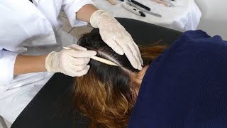 ASMR | Detailed SCALP Check + BACK Inspection, Tracing & Massage (Real Person)