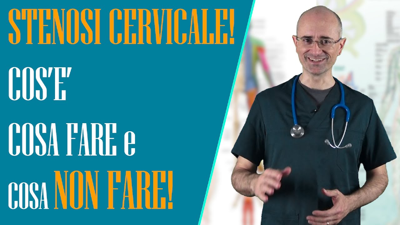 Stenosi cervicale! Cos'è, cosa fare e cosa NON FARE! - YouTube