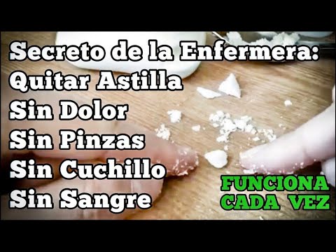 Video: Cómo quitar una astilla sin dolor: 11 pasos (con imágenes)