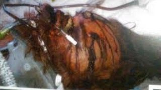 Wtf News - Chinese Cannibal And The Zombies Apocalypse Spreads