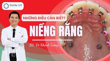 Niềng răng I NHỮNG ĐIỀU CẦN BIẾT KHI NIỀNG RĂNG? P2 I Nha Khoa Smile HT