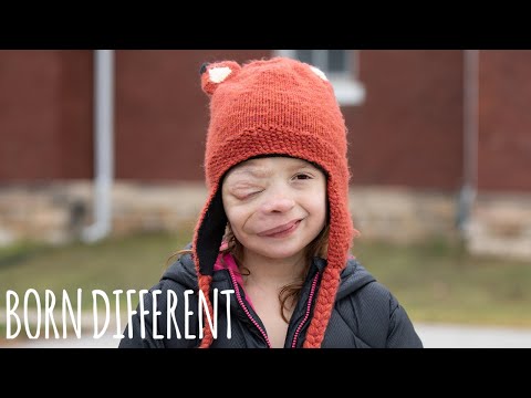 Brave 10-Year-Old Battles Rare Facial Tumour | BORN DIFFERENT