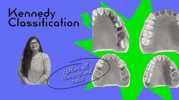 Kennedy’s Classification of Partially Edentulous Arches | Dr. Rashmi Singh