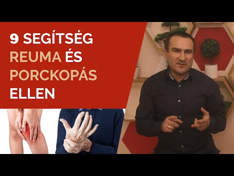 Videó: Az osteoarthritis fájdalom kezelése: 9 lépés (képekkel)