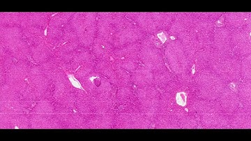 Human liver (H&E Staining) - PUMS Histology Slides Review Series