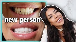 My Teeth transfortmation Veneers experience