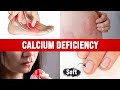 Best Home Test for a CALCIUM DEFICIENCY