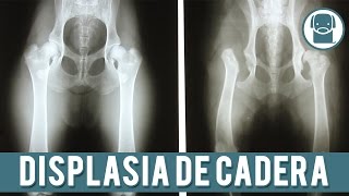 Displasia De Cadera En Perros | Prevención, Síntomas y Tratamiento