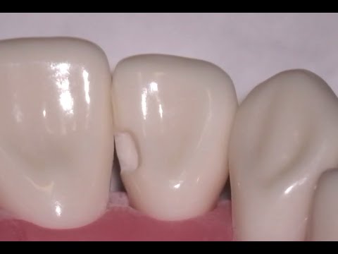 #10 ML Composite Preparation