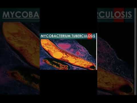 Mycobacterium tuberculosis (introduction, morphology, pathogenesis, lab diagnosis)