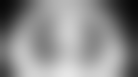 Uniportal VATS fissureless right lower lobectomy