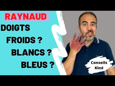 Vidéo: Sous l'influence du froid et du stress, ses doigts deviennent complètement blancs. Ceci est un symptôme de la maladie rare de Raynaud