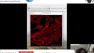 Technical Tea Break -  Introduction to Image Analysis with FIJI, Stefania Marcotti