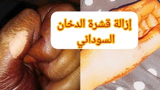 إزالة قشرة الدخان السوداني/طريقة عمل عروكة الخبز للدخان السوداني/الدخان السوداني للتفتيح والتبيض