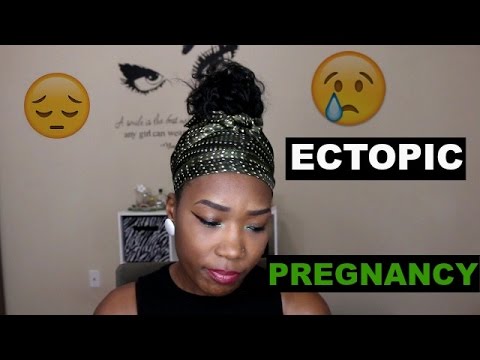 they-took-my-baby-&-fallopian-tube:-ectopic-pregnancy(gets-emotional)