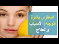 اصفرار بشرة الوجه الأسباب والعلاج طرق إرجاع الحيوية للبشرة اصفرار بشرة الوجه الأسباب والعلاج طرق إرجاع الحيوية للبشرة