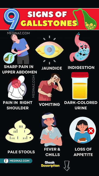 10 Early Signs of Gallstones – Don’t Miss These Symptoms!