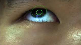 Pupil-iris Tracking using a RGB-IR Camera