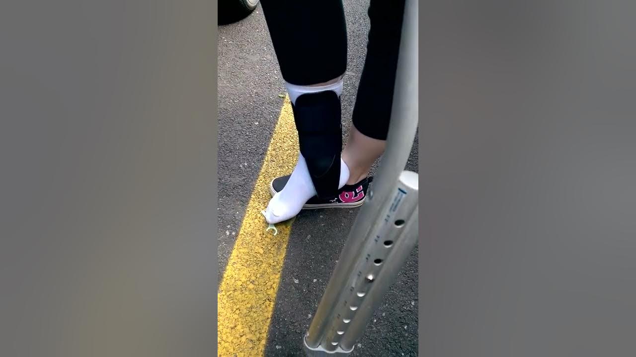 On crutches at restaurant YouTube