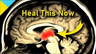 HEAL YOUR THALAMUS ❯❯❯ 2 Hz DELTA Waves • Neurologic Music Therapy • Quantum Miracle Formula Code