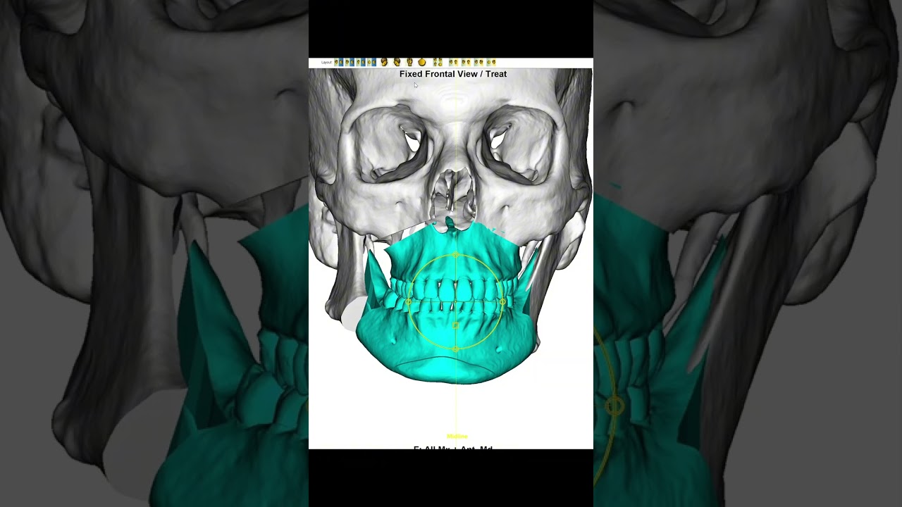 “Facial asymmetry? Asymmetric teeth? Here’s how orthognathic surgery can transform your face and
