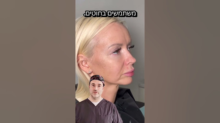 שליש תחתון של הפנים “נופל”? החוטים כאן כדי להרים 💥