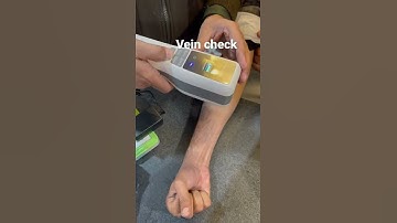 how to check your vein#vein finder