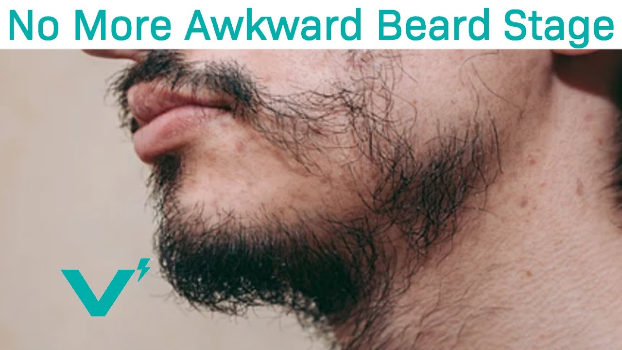 Skip The Awkward Beard Stage With These Tips YouTube Skip The Awkward Beard Stage With These Tips YouTube