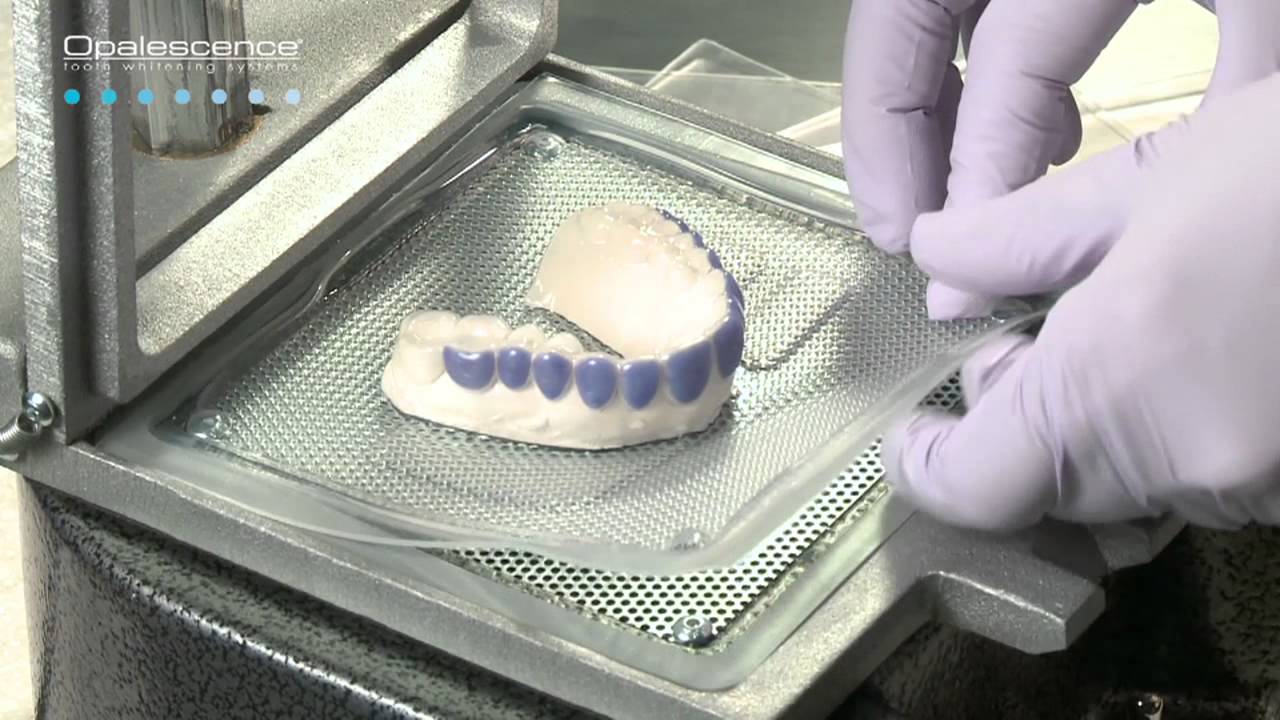 Ultradent LC Block  Out  Part 4 Proper Removal of Tray  