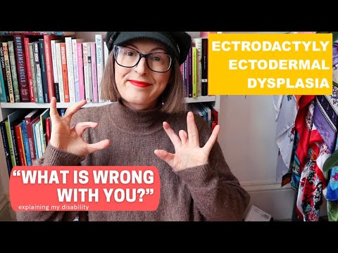 My Disability | EEC Syndrome / Ectodermal Dysplasia
