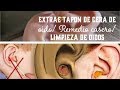 ELIMINA TAPÓN DE CERA EN OÍDOS/ LIMPIEZA DE OREJAS CON AGUA OXIGENADA PARA CURAR HERIDAS!!