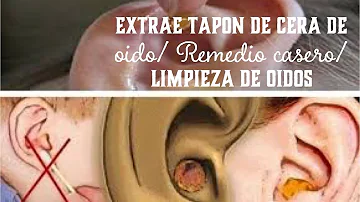 ¿Cómo quitar un tapón de cera del oído en casa con agua oxigenada?