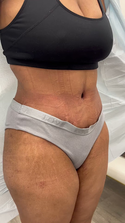 What procedure did she have?