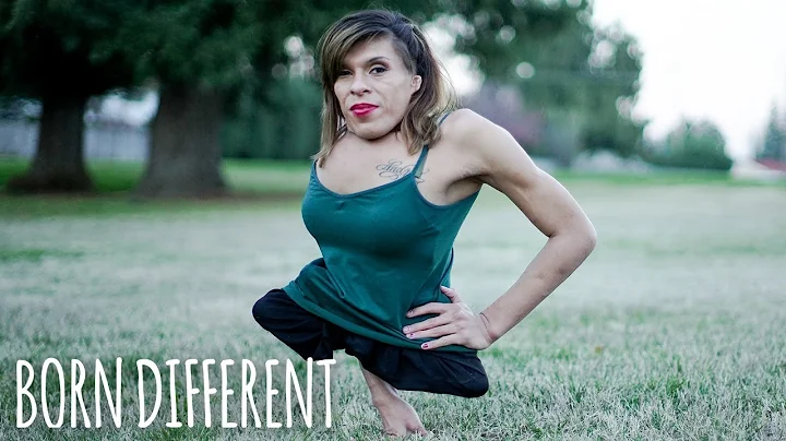 Trans Woman Born With Half A Body Finds Love | BOR...