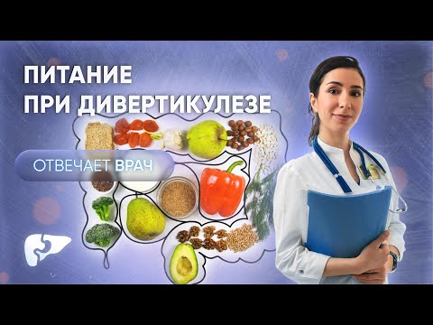 Питание при дивертикулярной болезни: овощи, фрукты, кофе и алкоголь